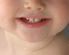 Children teeth